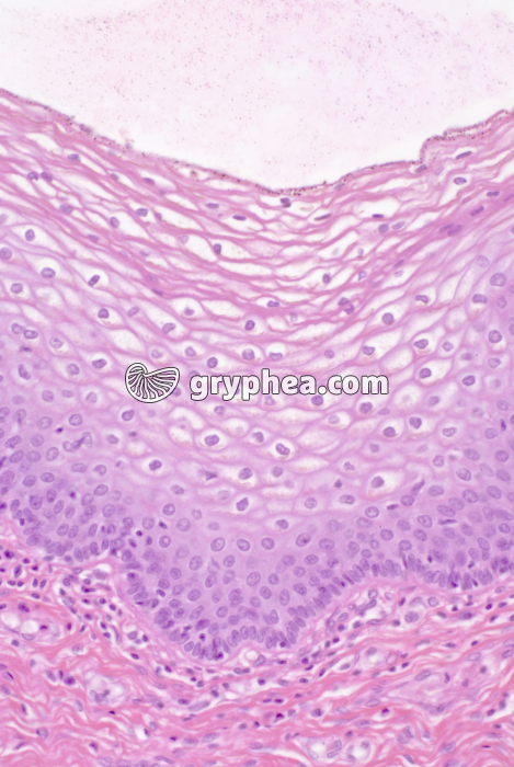 Muqueuse vaginale x100 - gryphea.com